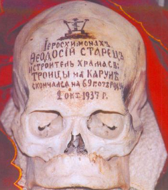 Как не бояться ринопластики Как не бояться ринопластики