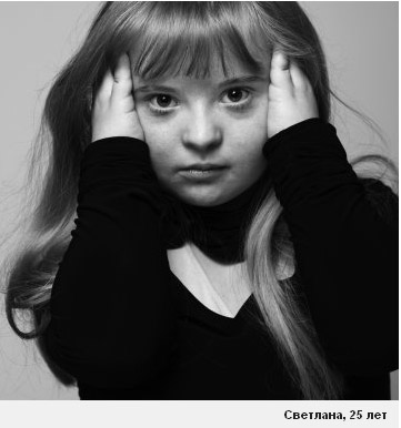 Отношение к детям с синдромом дауна