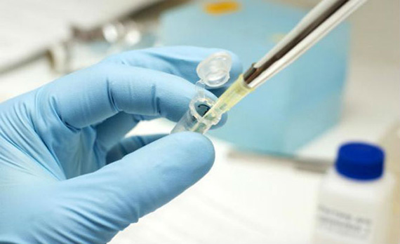 Autism-Vaccines-And-Cells-From-Aborted-Babies