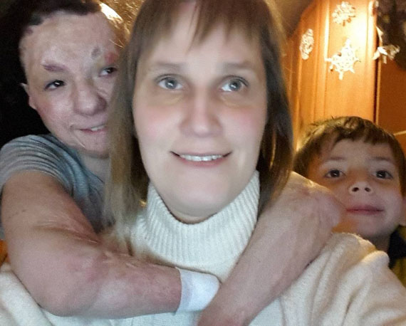 99