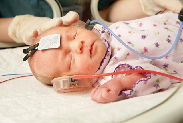 Новорожденный ребенок со слуховым оборудованием