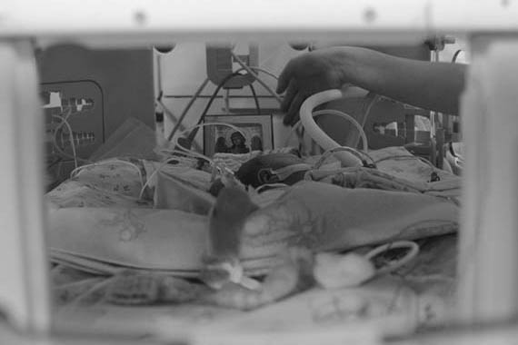 Новорожденный ребенок подключен к аппарату жизнеобеспечения