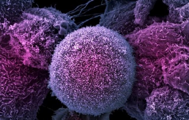 Клетки лимфоцитов под микроскопом