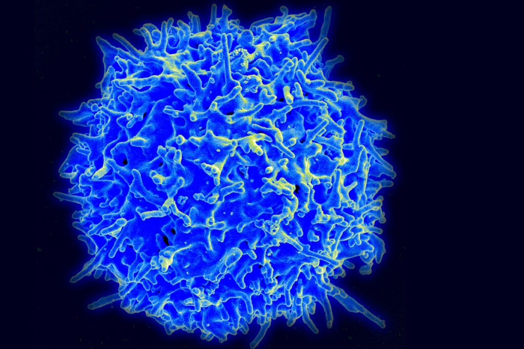 Электронная микрофотография человеческого Т-лимфоцита (Т-клетка) из иммунной системы здорового донора
