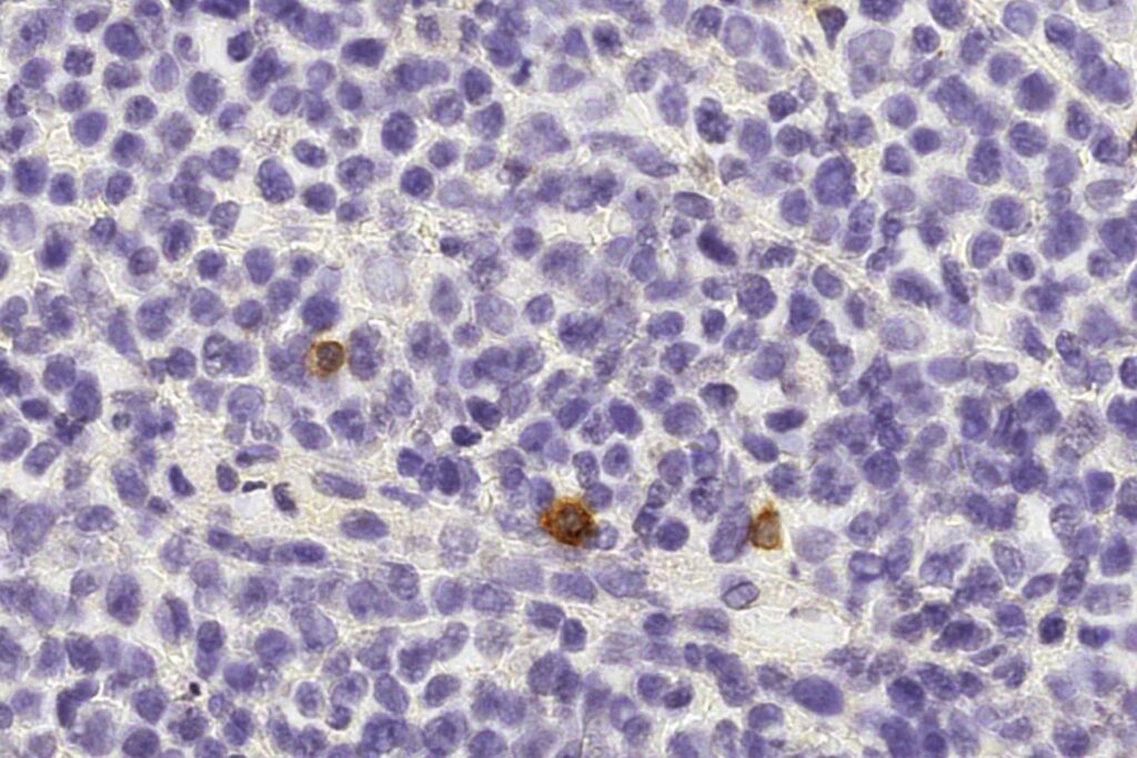 NK-клетки (коричневые) патрулируют клетки здорового лимфатического узла человека. Фото: Institute of Pathology, University of Bern