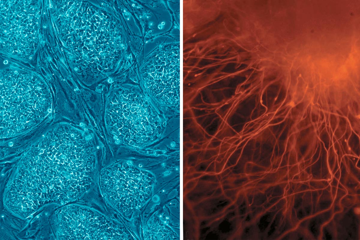 Эмбриональные стволовые клетки. Стволовые клетки микрофотография. Эмбриональные стволовые клетки человека. Фетальные стволовые клетки под микроскопом. Эмбриональные стволовые клетки под микроскопом.