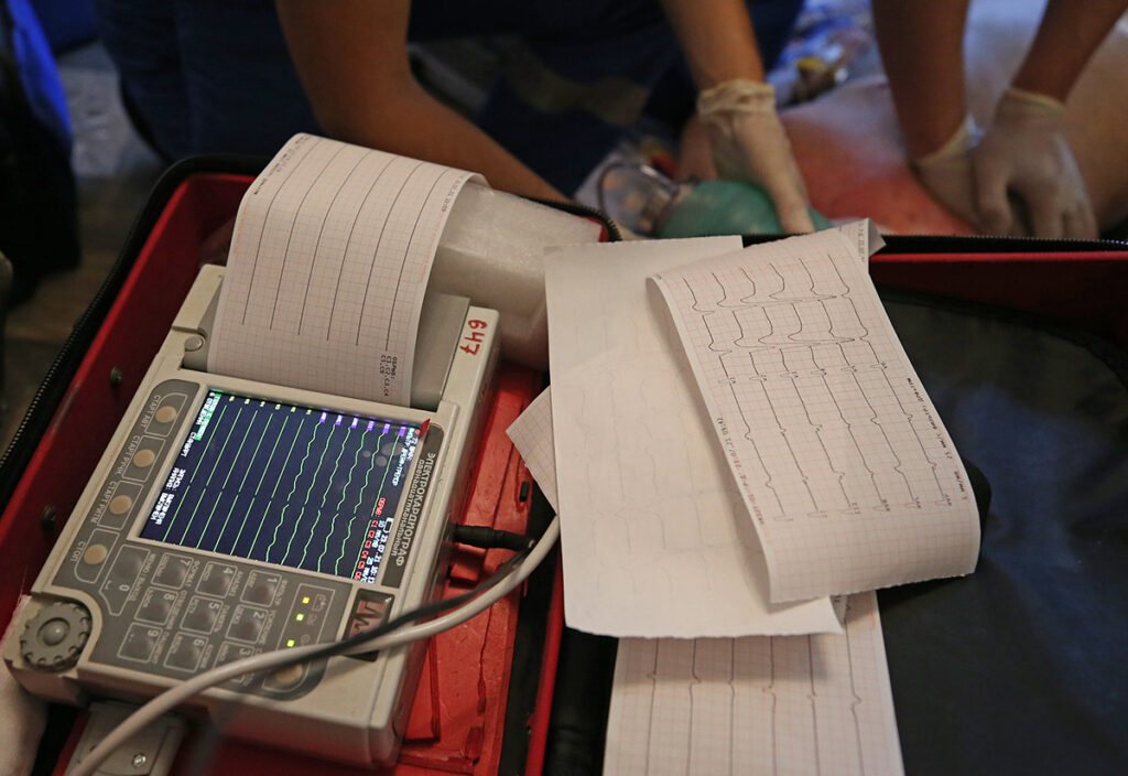 Портативный электрокардиограф во время вызова фельдшеров скорой помощи к пациенту