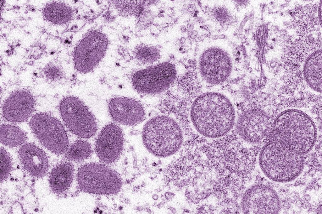 Снимок вирусных частиц оспы обезьян