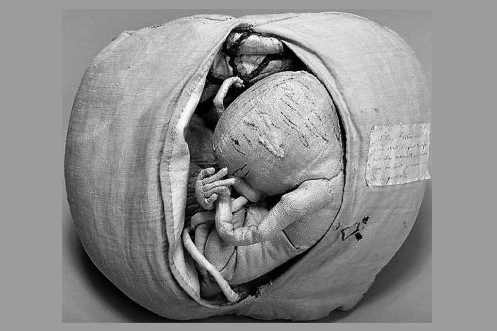 Манекен дю Кудре, используемый для обучения искусству родов, плод на семи месяцах в утробе