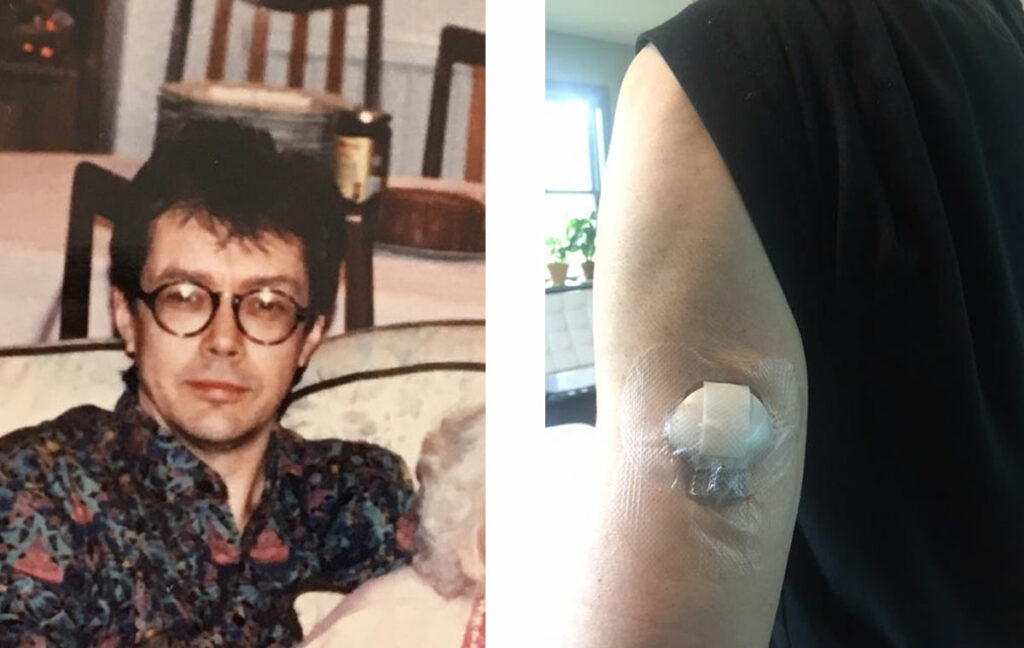 Ричард Тун в 23 года, когда ему поставили диагноз. Справа – датчик Medtronic на его руке