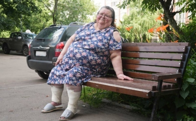 Женщина с больными ногам на скамейке