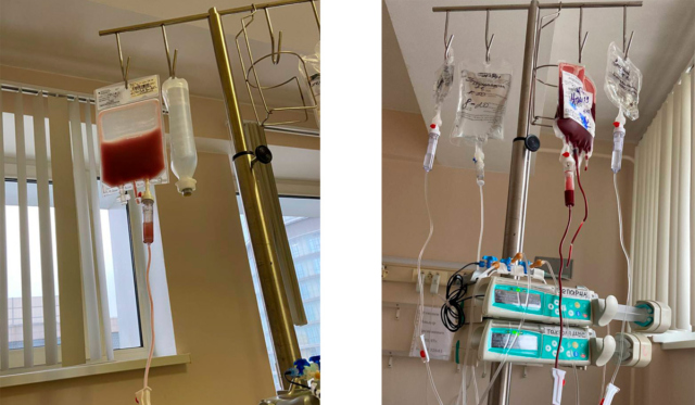 Препараты по пересадке костного мозга. Стволовые клетки/костный мозг от донора