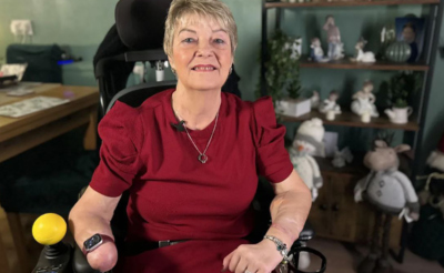 Женщина в инвалидной коляске с ампутированной кистью