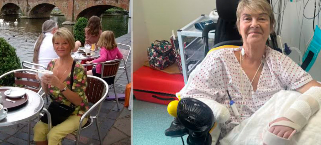 Ким Смит до болезни и после операции по трансплантации руки