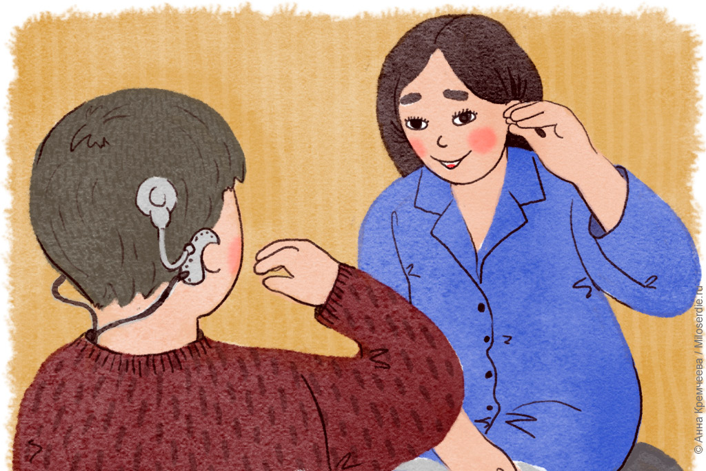 Рисунок. Кохлеарная имплантация. Реабилитация 