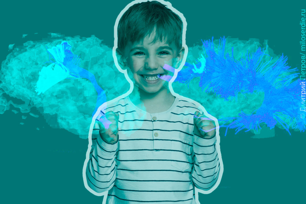 Коллаж. Синдром Аспергера