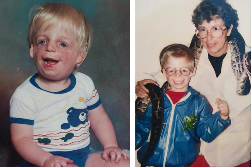 Джоно в детстве и с приемной мамой. Фото: соцсети Jono Lancaster