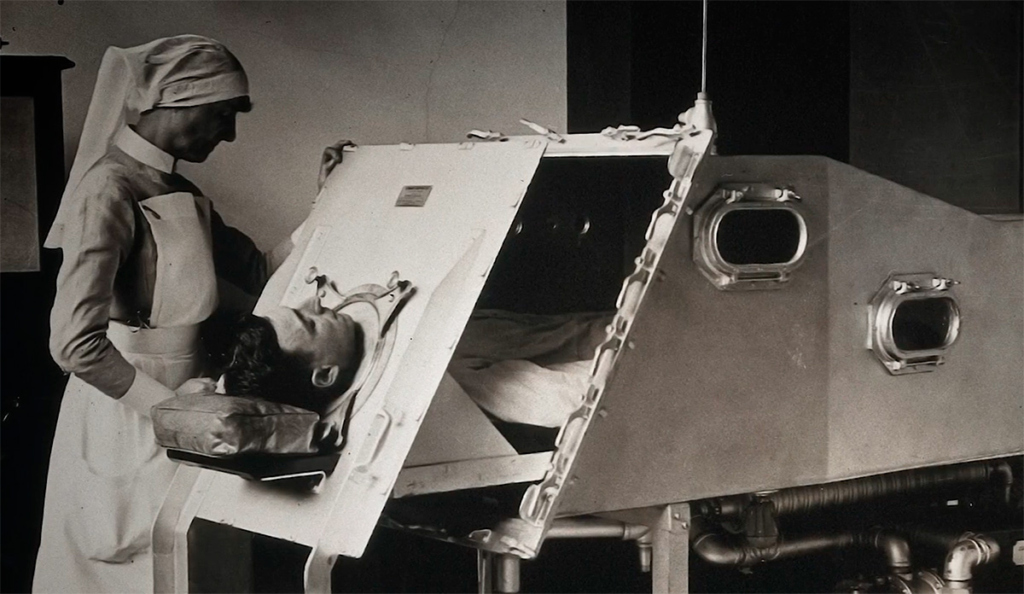Адольф Ратцка в железных легких. Скриншот с видео Paralyzed by Polio at 17 / My Time Inside an Iron Lung / Mütter Museum of the College of Physicians of Philadelphia