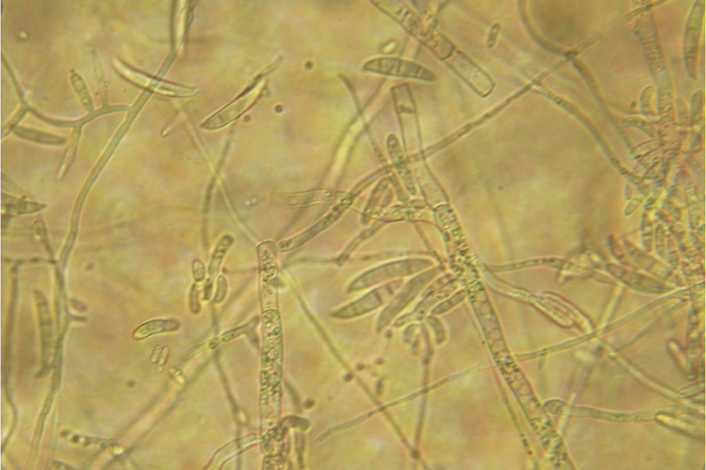 Конидии грибов рода Fusarium