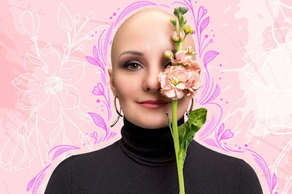 Женщина с аллопецией
