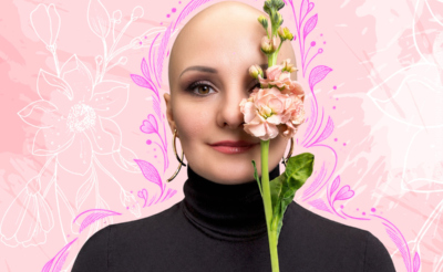 Женщина с аллопецией